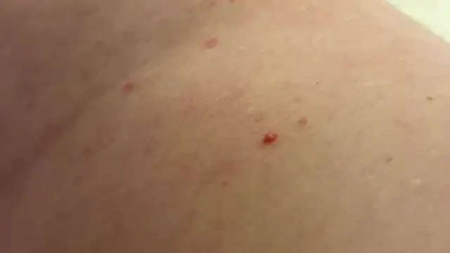 andrenoma427 online show from 01.13.26